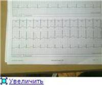 Водные виды спорта: У кого какой пульс уд  мин  показывает на ЭКГ