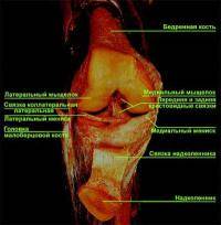 Фитнес и бодибилдинг: Болят связки надколенника