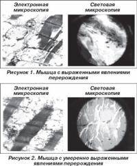 Экстремальные виды спорта: миофибриллы и митохондрии